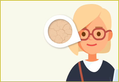 Solve my acne quiz