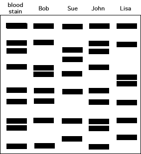 Printables Gel Electrophoresis Worksheet quizizz question set gene technology