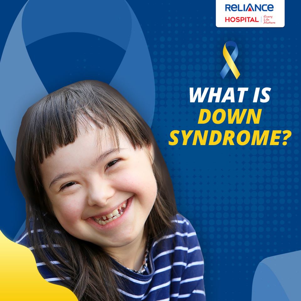 What is down syndrome?