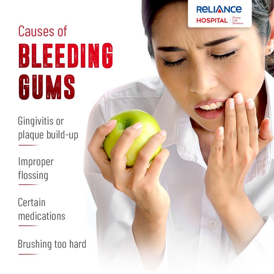 Causes of bleeding gums