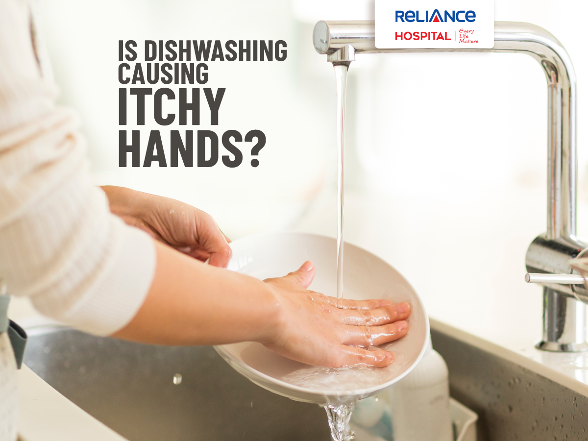 Is dishwashing causing itchy hands?