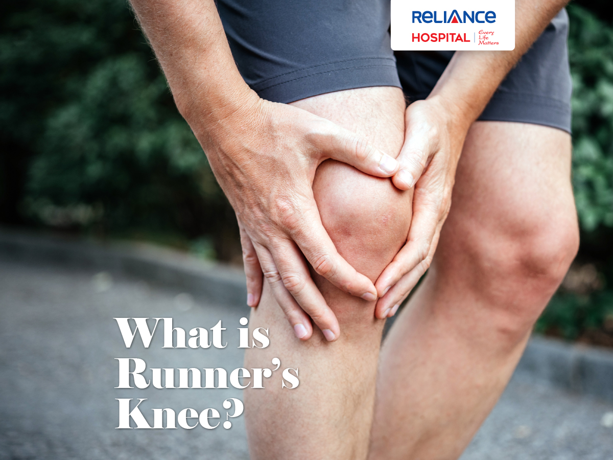 What is runner's knee?