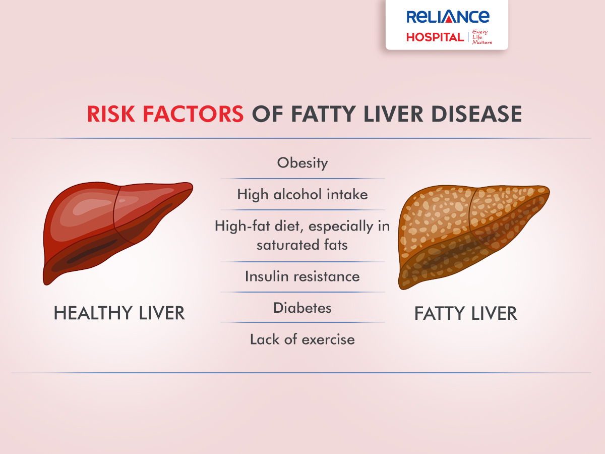 Risk factors of fatty liver disease