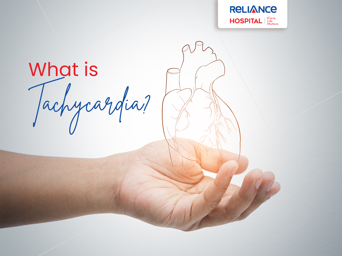 How Long Does Atrial Tachycardia Last Best Design Idea