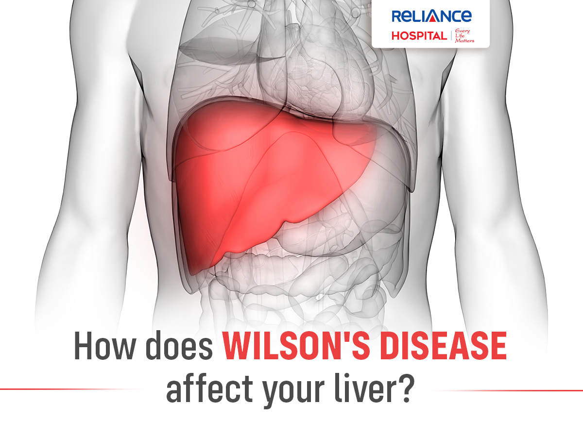 How does Wilson's Disease affect your liver?