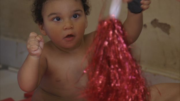 El primer año de vida es un período fundamental para el desarrollo del cerebro y la visión de los niños afectados por el zika, según expertos.