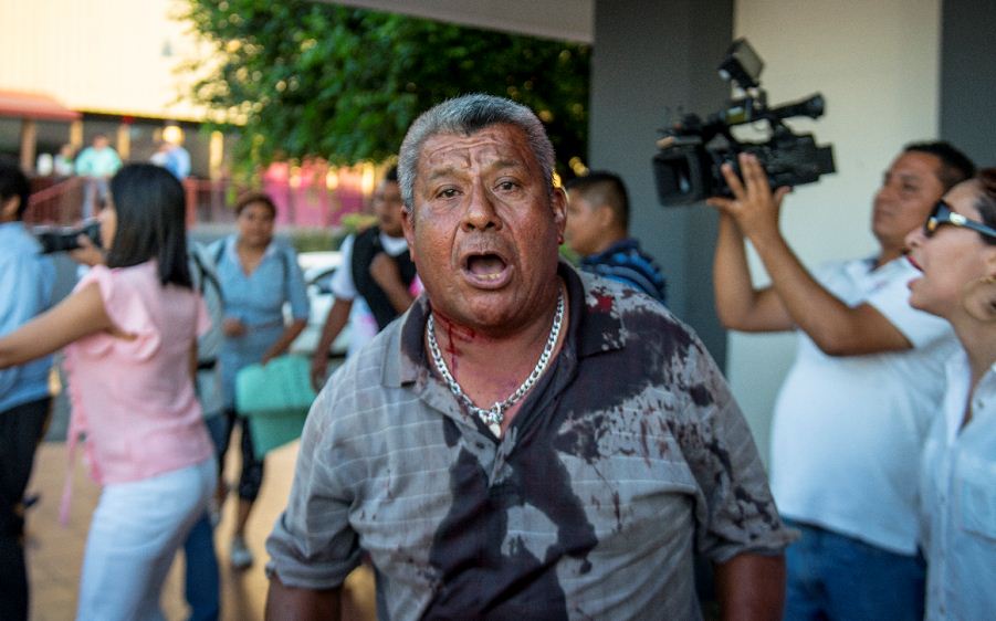 Anciano agredido por la Juventud Sandinista en Camino de Oriente. LA PRENSA/ Wilmer López