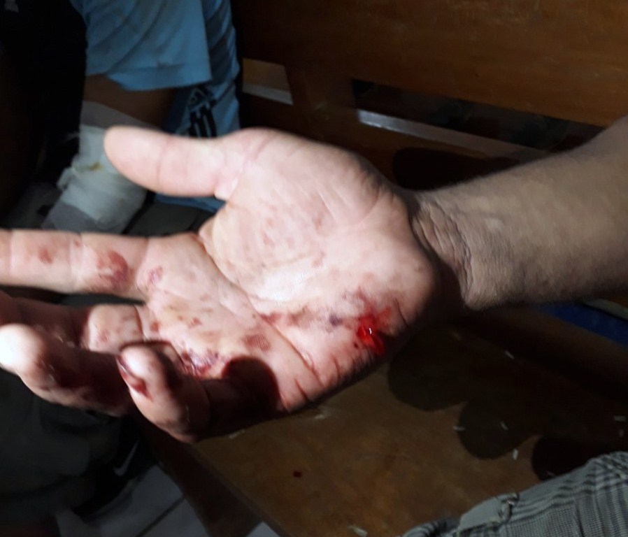 Los heridos en Sébaco la noche de este lunes, tras los ataques de las turbas del Gobierno, fueron trasladados a la iglesia del pueblo. LA PRENSA/ LEONOR ÁLVAREZ