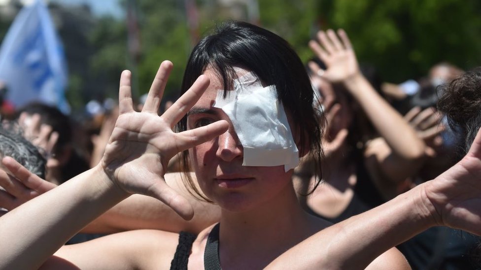 Chile, protestas, perdigones