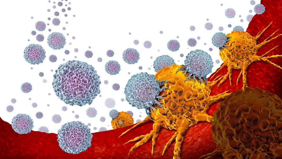 servicios de apoyo para el cáncer de próstata