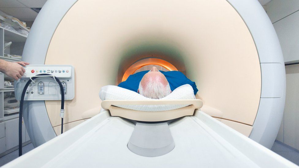 cobertura médica para biopsia de próstata
