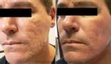 Medical Laser and IPL Clinic gallery image 2