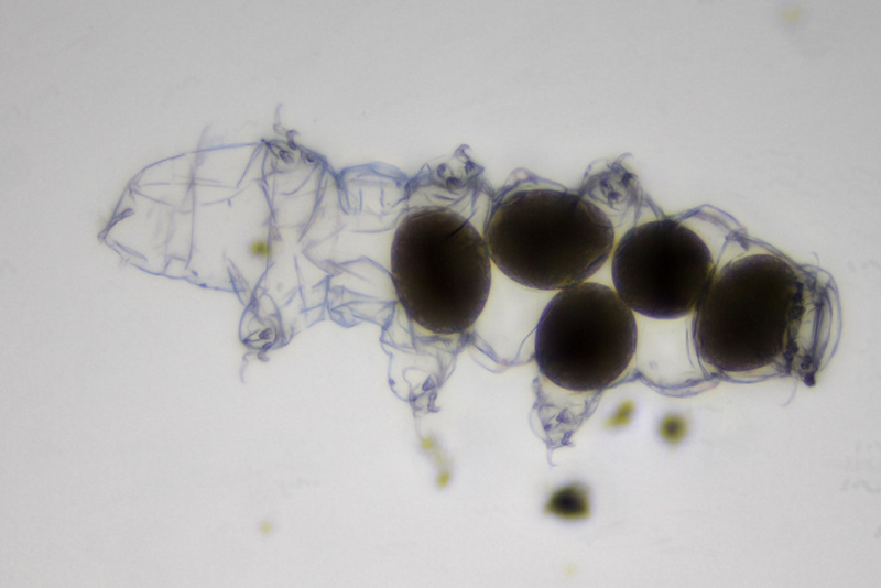 "Water bear focus stacked" by Specious Reasons is licensed under CC BY-NC 2.0.