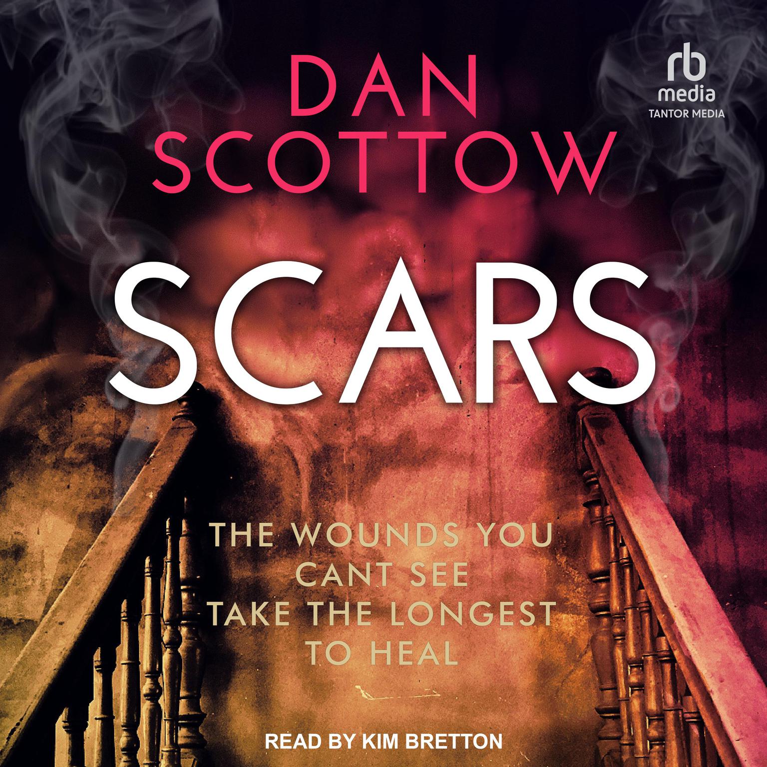 Scars Audiobook by Dan Scottow, read by Kim Bretton