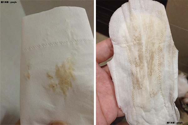 為什麼會有咖啡色分泌物 月經咖啡色先別擔心 六大原因一次了解 Mamibuy編輯部 媽咪拜mamibuy