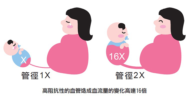 子癲前症 孕婦死因前三名 早期篩檢 飲食照護很重要 保護肚子小生命 Mamibuy編輯部 媽咪拜mamibuy