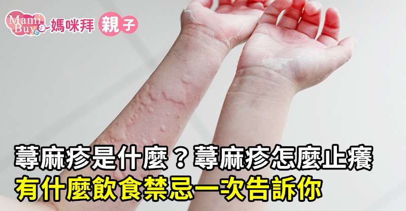蕁麻疹是什麼 蕁麻疹怎麼止癢 有什麼飲食禁忌一次告訴你 媽咪拜mamibuy