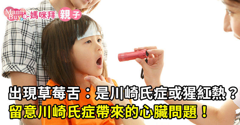 出現草莓舌 是川崎氏症或猩紅熱 留意川崎氏症帶來的心臟問題 Mamibuy編輯部 媽咪拜mamibuy