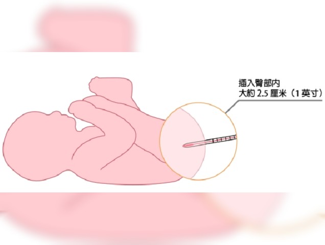 嬰兒發燒處理