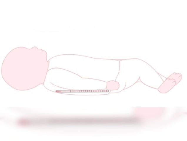 新生兒發燒