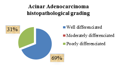 Acinar adenocarcinoma histopathological grading