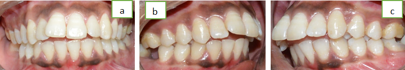 Pre- treatment photographs