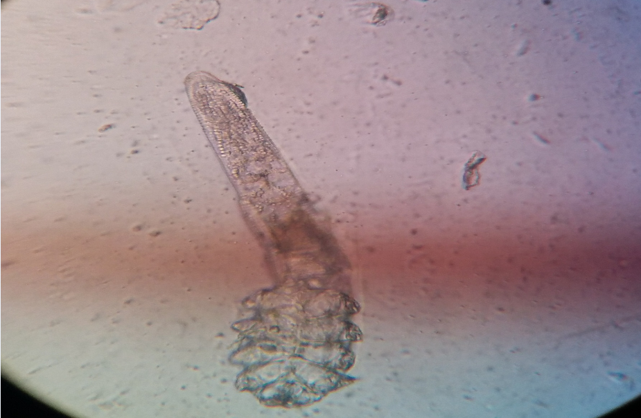 Demodex mites away from lash