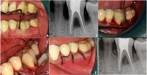 Case 1