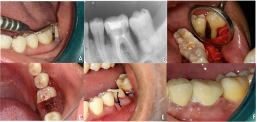 Case 2