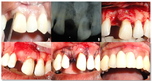 Case 4