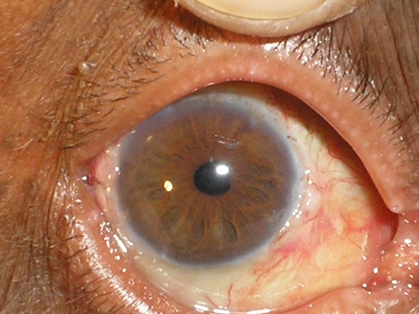 Postoperative pic.