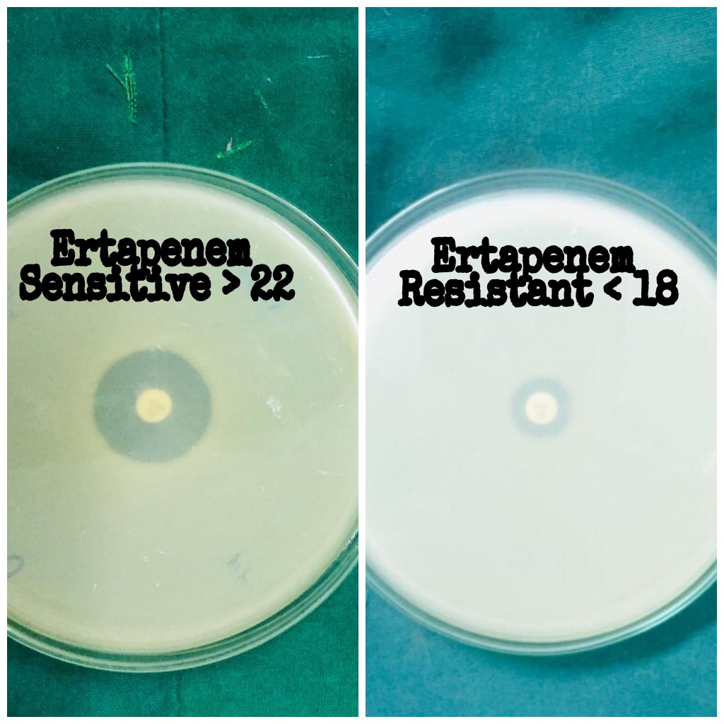 Photograph showing Ertapenem (10μg) disk sen sit ivity and resistance by Kirby Bauer disk diffusion method.
