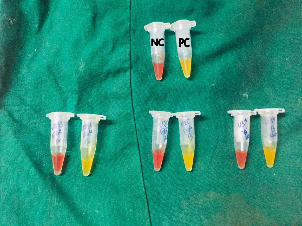 Picture showing results of Carba NP test with positive and negative controls. 