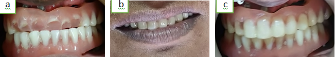 a-c