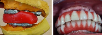 a,b