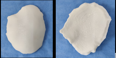 3D printedCranial mold of PLA
