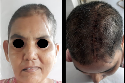 Post operative Frontal View of the Patient