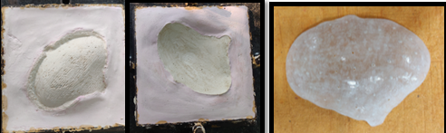 Laboratory Fabrication of PMMA Cranial Plate