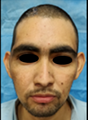 Postoperative Profile of the Patient