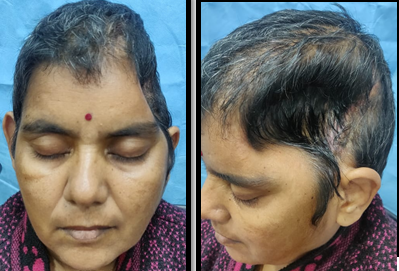 rontal and Lateral Profile of the patient