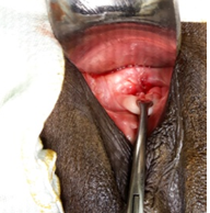 4wks postoperative Cervix visualised