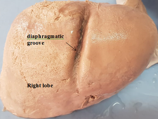 Diaphragmatic Groove on superior surface of right lobe of Liver