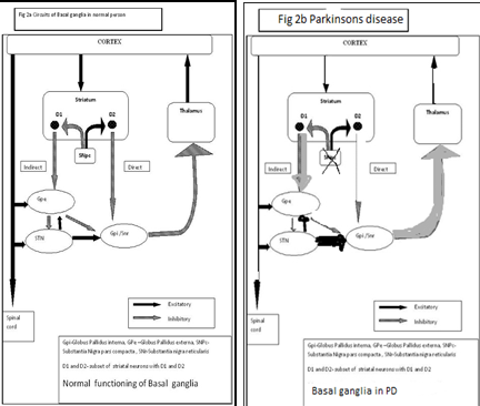 Normal and abnormal functioning of basal ganglia in Parkinson`s7 