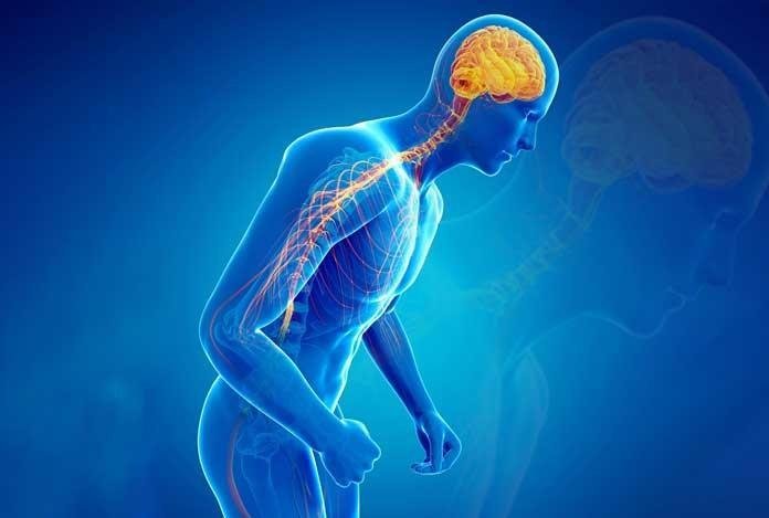 Phantom sensations of a typical Parkinson.