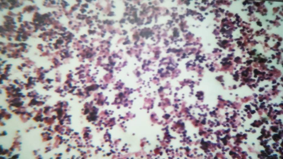 Cortex with densely packed small lymphocytes in 24 weeks fetus, H & E, 100x.