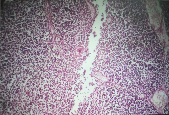 Medulla with Hassall’s corpuscle in 24 weeks fetus, H &E, 40x
