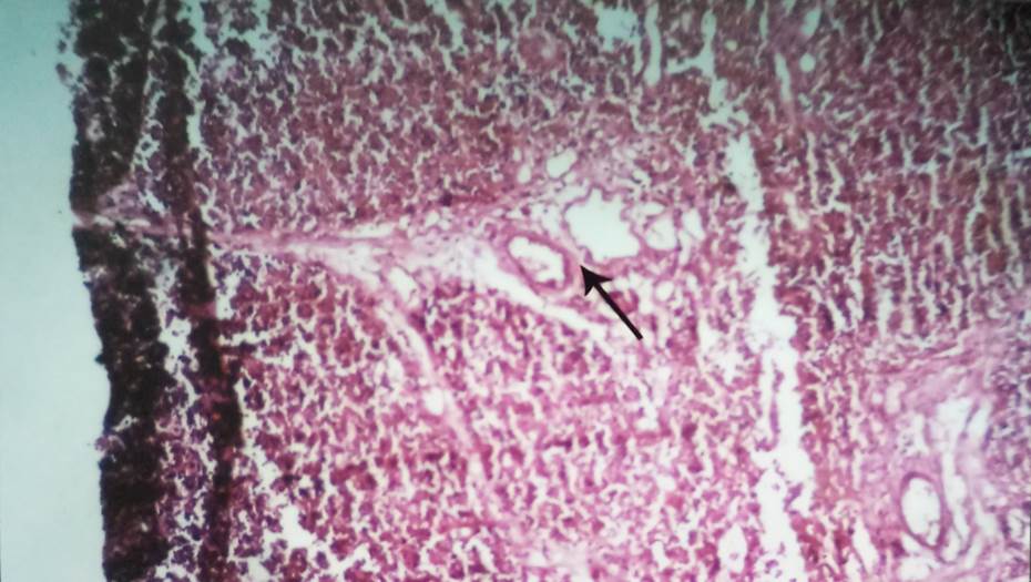 Interlobular septa with blood vessels in 26 weeks fetus, H & E, 40x