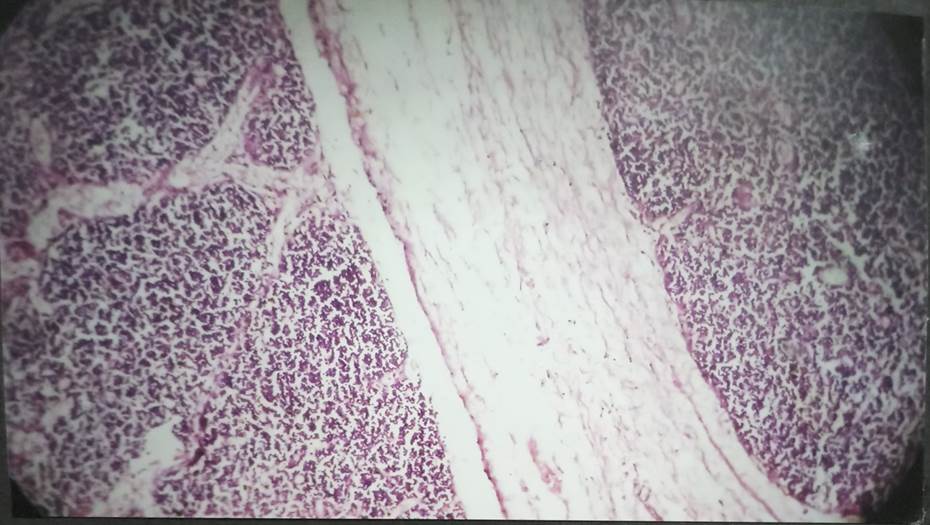 Interlobular septa in 31 weeks fetus, H & E, 40x
