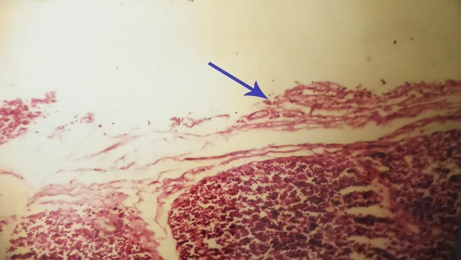 Capsule of thymus gland in 18 weeks fetus, H & E, 40x