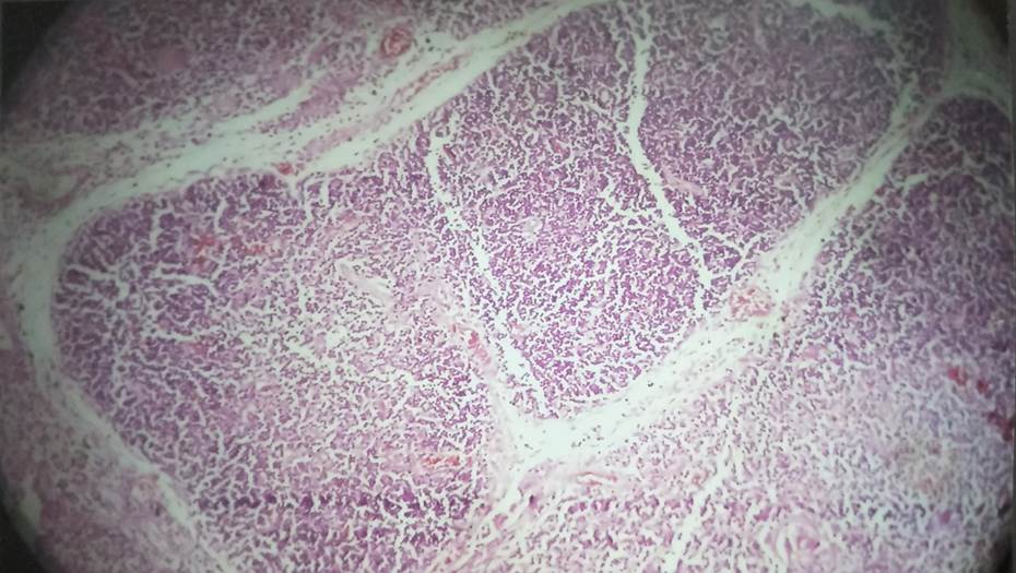 Lobule with cortex and medulla of 22 weeks fetus, H & E, 40x